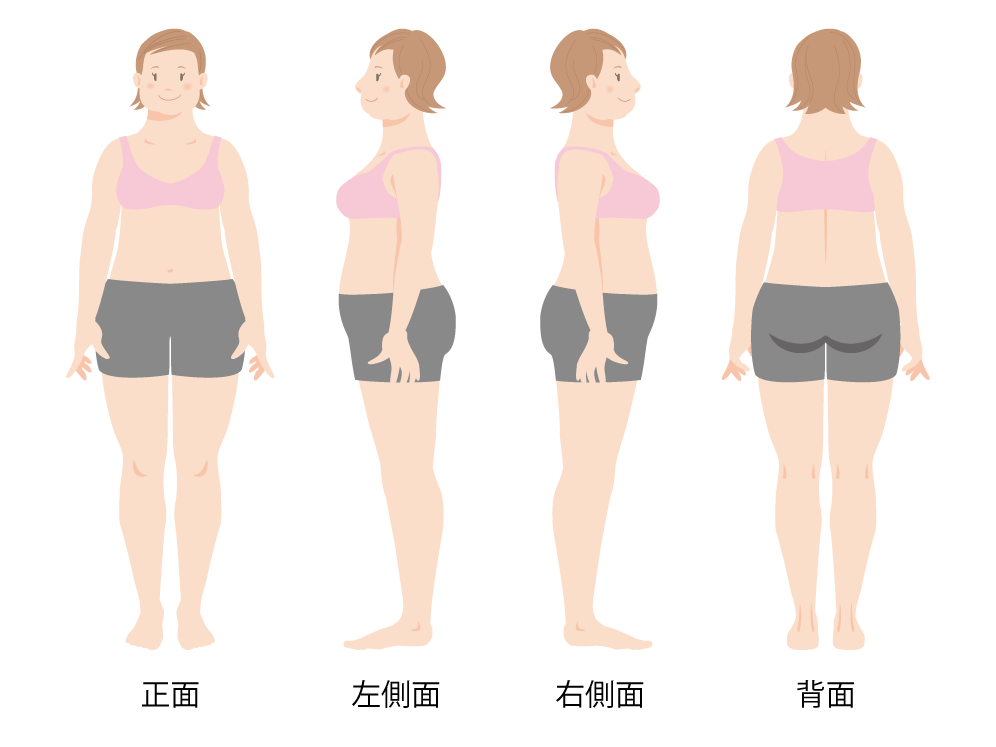 マナ酵素　写真例4方向
